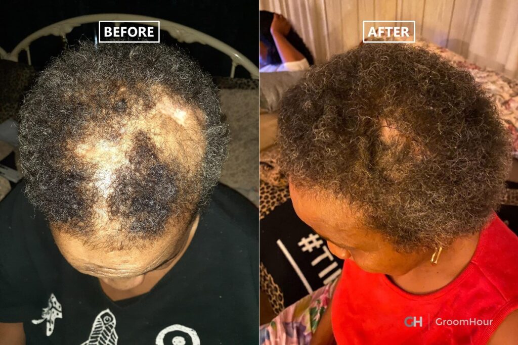 Jamaican Black Castor Oil for Hair Growth Before and After
